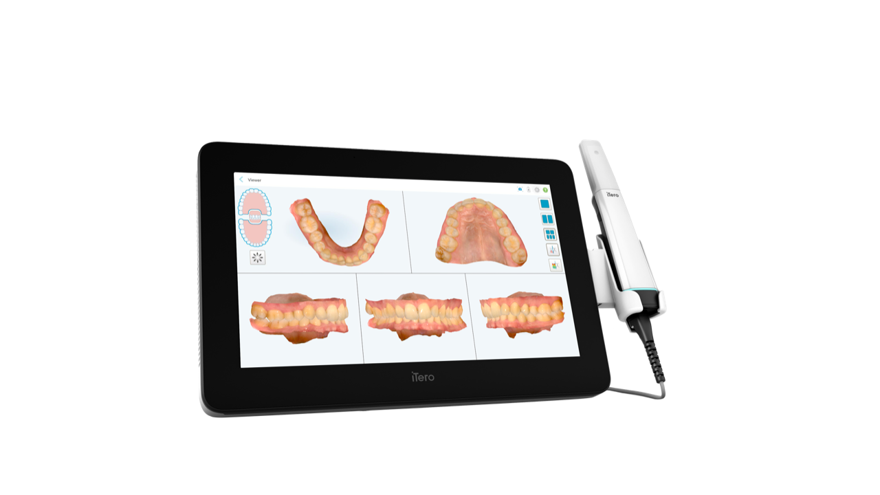 iTero Lumina Pro, tablette et baguette avec rendu 3D